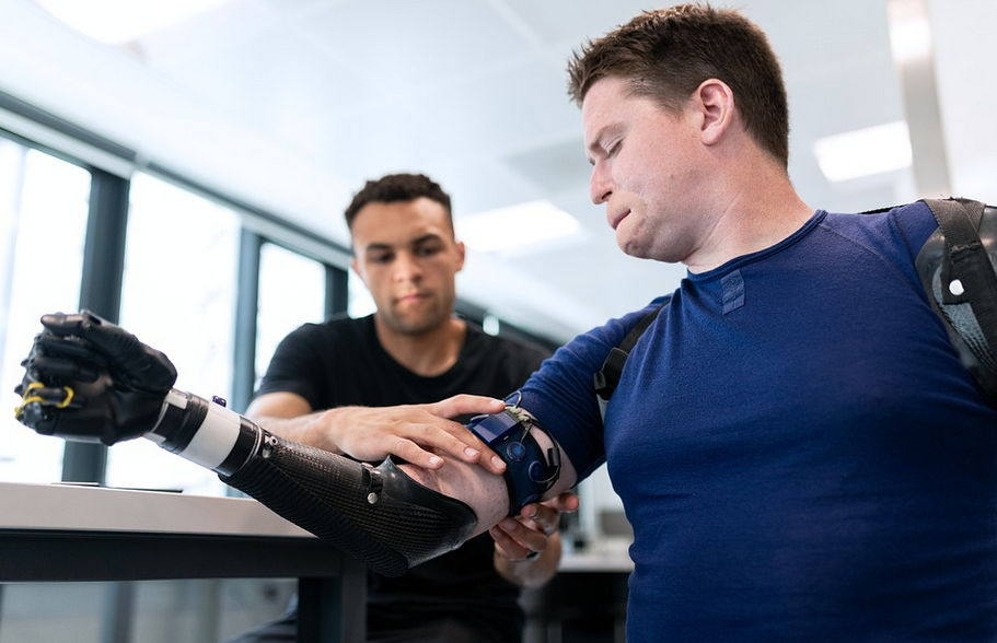 prosthetics